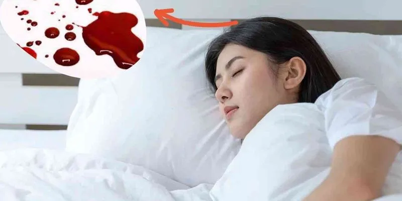 Ý nghĩa của giấc mơ thấy máu